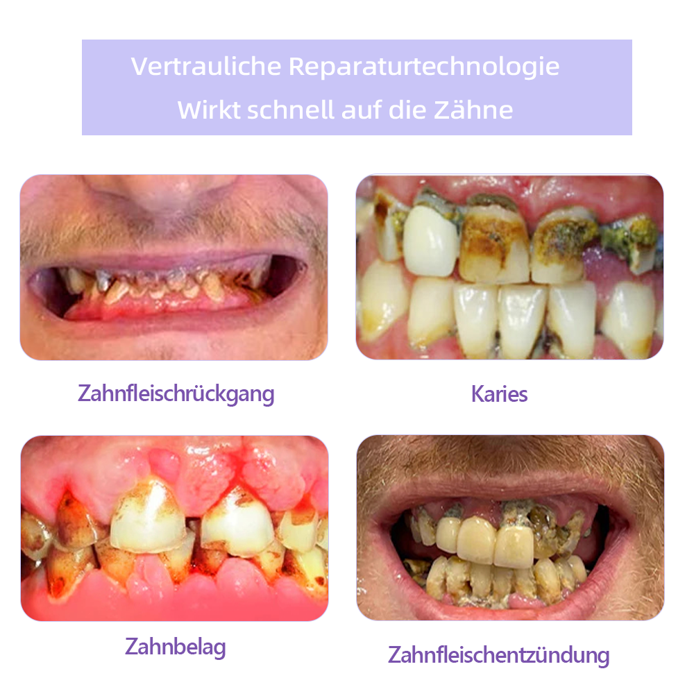 Tnnedey™ Zahnreparatur-Mineralpuder💎(Empfohlen von der EAD)