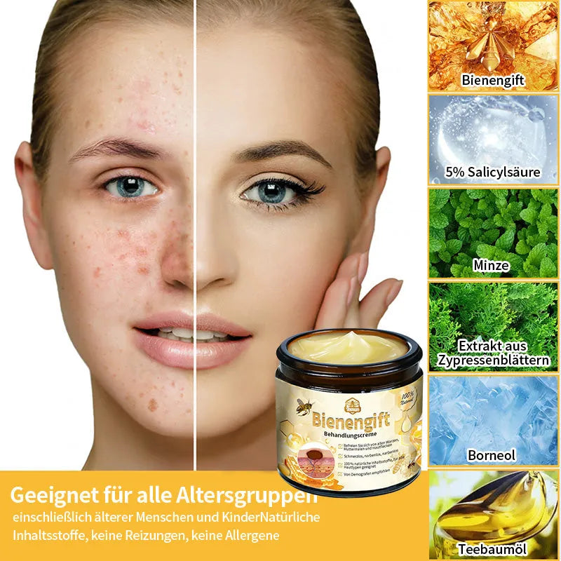 [Herbst-Hautpflege] 𝐓𝐧𝐧𝐞𝐝𝐞𝐲 Bienengift-Hautpflegecreme (AAD Empfohlen) 👨‍⚕️(Letzte Tag Promotion, 80% Rabatt)