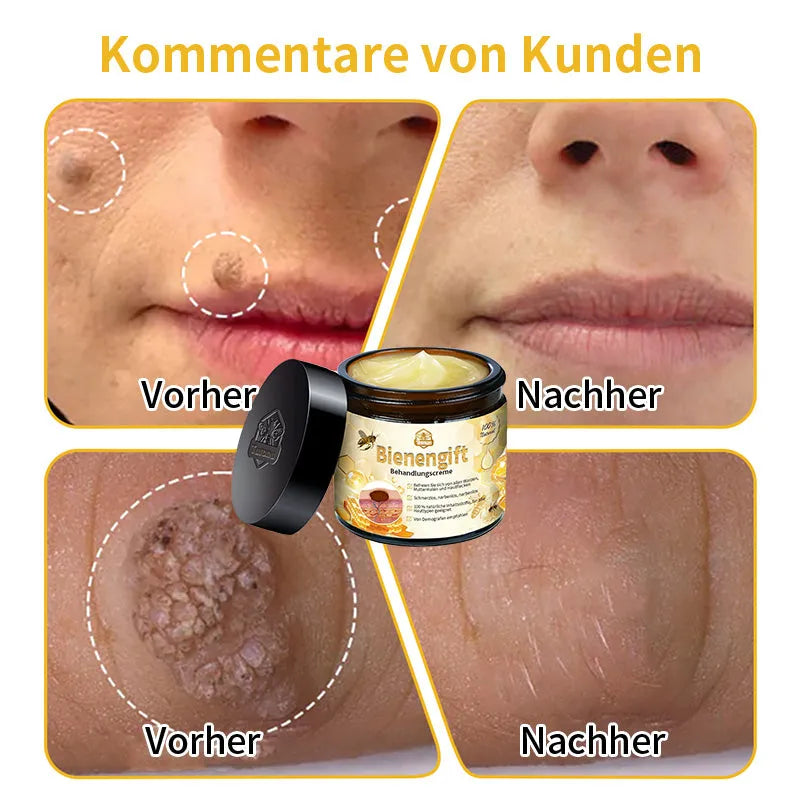 [Herbst-Hautpflege] 𝐓𝐧𝐧𝐞𝐝𝐞𝐲 Bienengift-Hautpflegecreme (AAD Empfohlen) 👨‍⚕️(Letzte Tag Promotion, 80% Rabatt)