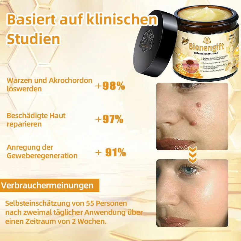 [Herbst-Hautpflege] 𝐓𝐧𝐧𝐞𝐝𝐞𝐲 Bienengift-Hautpflegecreme (AAD Empfohlen) 👨‍⚕️(Letzte Tag Promotion, 80% Rabatt)