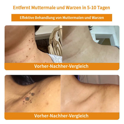 [Herbst-Hautpflege] 𝐓𝐧𝐧𝐞𝐝𝐞𝐲 Bienengift-Hautpflegecreme (AAD Empfohlen) 👨‍⚕️(Letzte Tag Promotion, 80% Rabatt)