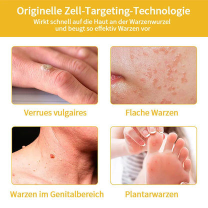 [Herbst-Hautpflege] 𝐓𝐧𝐧𝐞𝐝𝐞𝐲 Bienengift-Hautpflegecreme (AAD Empfohlen) 👨‍⚕️(Letzte Tag Promotion, 80% Rabatt)