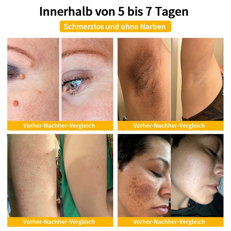 [Herbst-Hautpflege] 𝐓𝐧𝐧𝐞𝐝𝐞𝐲 Bienengift-Hautpflegecreme (AAD Empfohlen) 👨‍⚕️(Letzte Tag Promotion, 80% Rabatt)