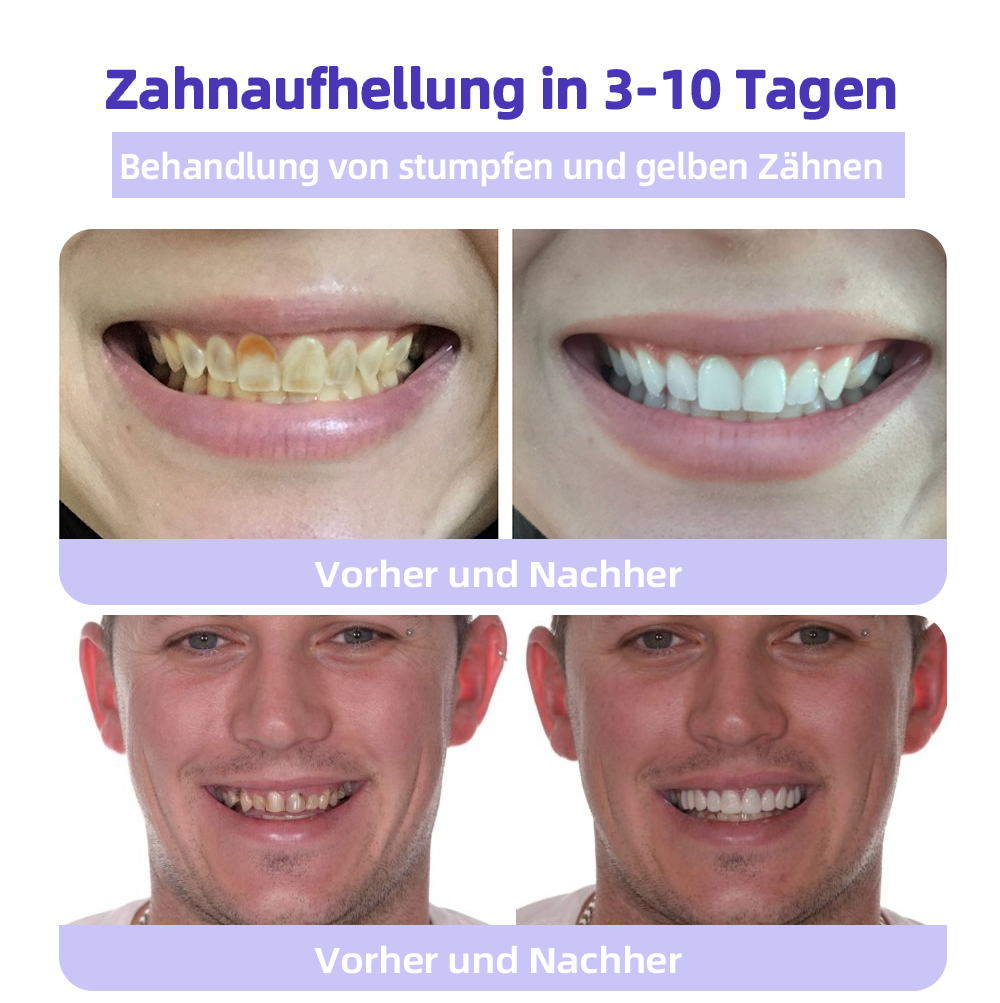 Tnnedey™ Zahnreparatur-Mineralpuder💎(Empfohlen von der EAD)