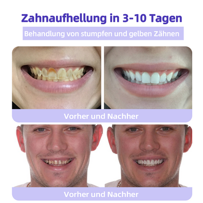 Tnnedey™ Zahnreparatur-Mineralpuder💎(Empfohlen von der EAD)