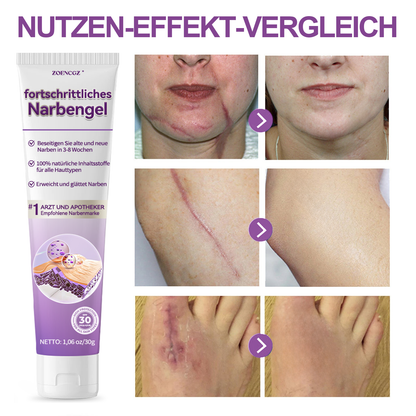 [ 𝐎𝐟𝐟𝐢𝐜𝐢𝐚𝐥 𝐒𝐭𝐨𝐫𝐞 ]  𝖹𝖮𝖤𝖭𝖢𝖦𝖹® Fortschrittliches Narbengel  Dermatologen-Empfehlungen