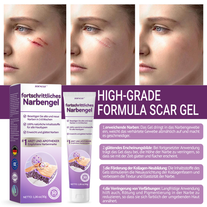 [ 𝐎𝐟𝐟𝐢𝐜𝐢𝐚𝐥 𝐒𝐭𝐨𝐫𝐞 ]  𝖹𝖮𝖤𝖭𝖢𝖦𝖹® Fortschrittliches Narbengel  Dermatologen-Empfehlungen