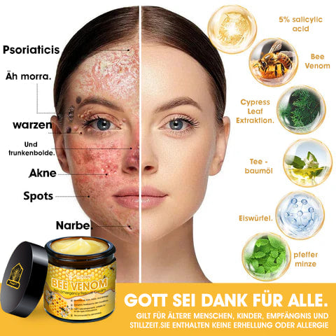 Tnnedey™ Bienengift Haut-Notfall-Rettungscreme (AAD empfohlen) 💆‍♀️ (Expertenempfehlung)