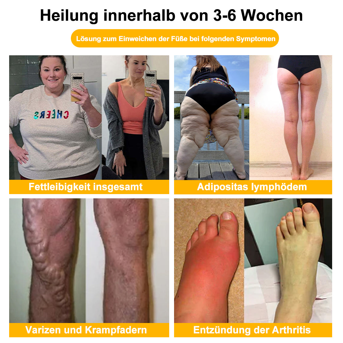 Tnnedey™ Bienengift Schlankheits-Detox-Fußbad-Perlen - 🌟(EU Lymphatic Association ELA zertifiziert)✅