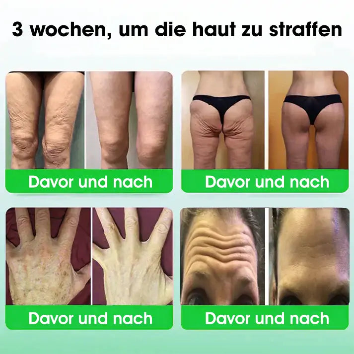 Tnnedey® 30 Kräuterstraffende Schlankheits- & Detox-Fußbadkugeln 🌿✨ - Effektive Behandlung für hohen Blutzucker 💉 und Arthritis 🦶💪