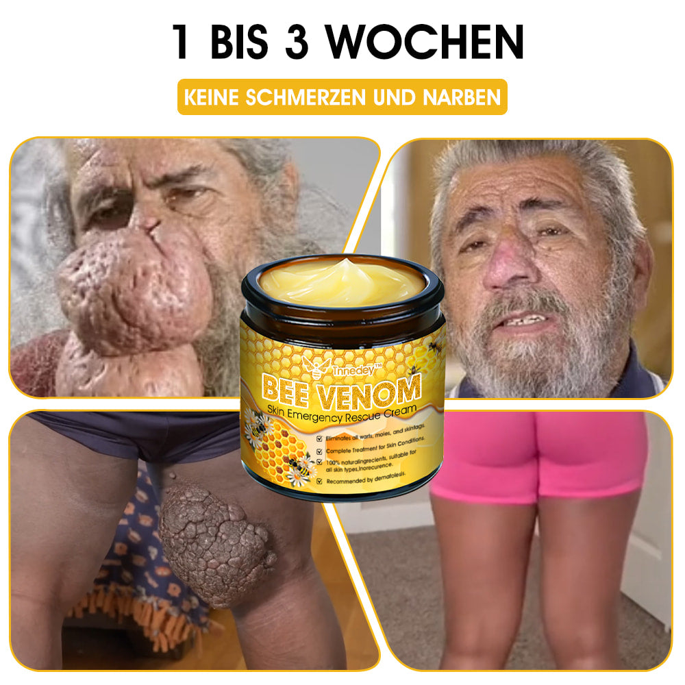 Tnnedey™ Bienengift Haut-Notfall-Rettungscreme (AAD empfohlen) 💆‍♀️ (Expertenempfehlung)