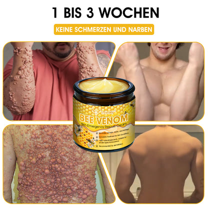 Tnnedey™ Bienengift Haut-Notfall-Rettungscreme (AAD empfohlen) 💆‍♀️ (Expertenempfehlung)