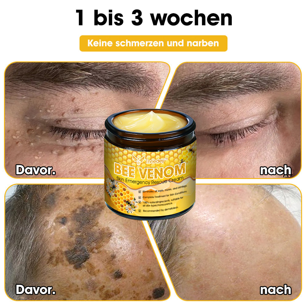 Tnnedey™ Bienengift Haut-Notfall-Rettungscreme (AAD empfohlen) 💆‍♀️ (Expertenempfehlung)