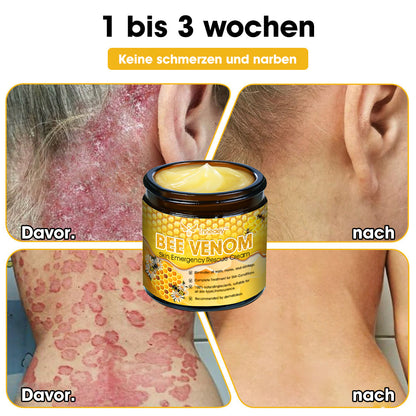 Tnnedey™ Bienengift Haut-Notfall-Rettungscreme (AAD empfohlen) 💆‍♀️ (Expertenempfehlung)