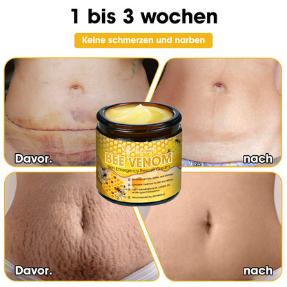 Tnnedey™ Bienengift Haut-Notfall-Rettungscreme (AAD empfohlen) 💆‍♀️ (Expertenempfehlung)