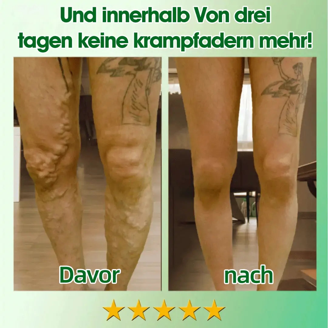 Tnnedey® 30 Kräuterstraffende Schlankheits- & Detox-Fußbadkugeln 🌿✨ - Effektive Behandlung für hohen Blutzucker 💉 und Arthritis 🦶💪