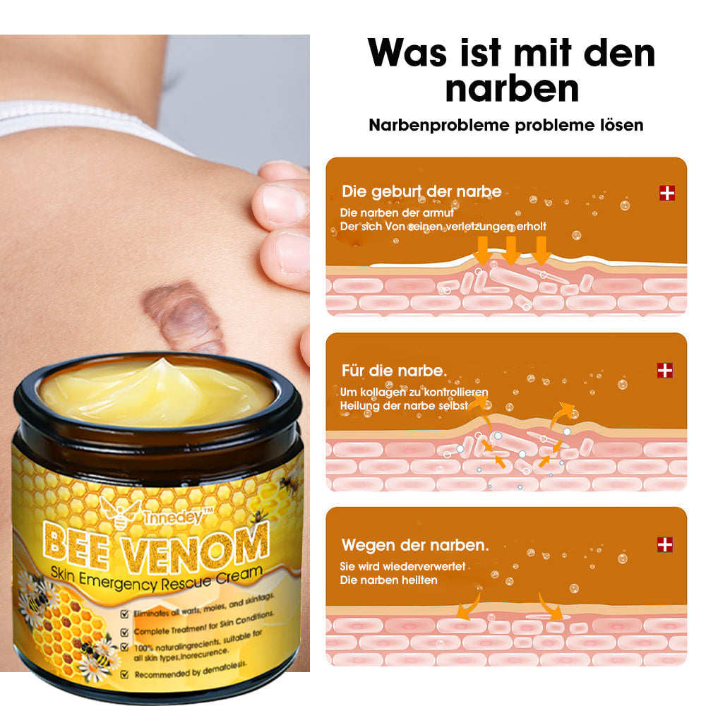 Tnnedey™ Bienengift Haut-Notfall-Rettungscreme (AAD empfohlen) 💆‍♀️ (Expertenempfehlung)