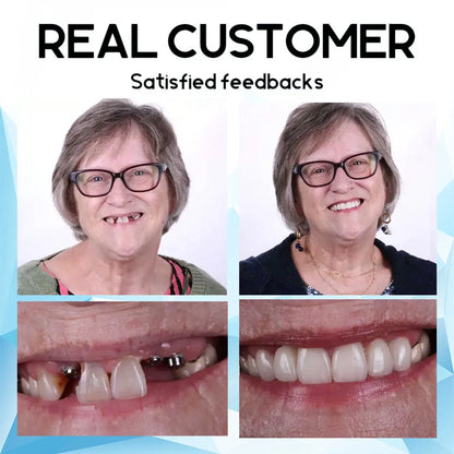 [Offizieller Shop]Bikenda™ Premium Custom Silicone Denture Set (⏰Zeitlich begrenztes Angebot – Nur noch 30 Minuten⏰)