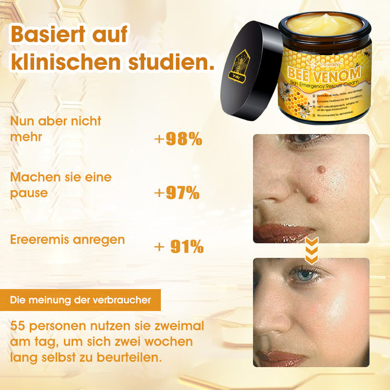 Tnnedey™ Bienengift Haut-Notfall-Rettungscreme (AAD empfohlen) 💆‍♀️ (Expertenempfehlung)