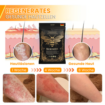 Tnnedey™ Bienengift Schlankheits-Detox-Fußbad-Perlen - 🌟(EU Lymphatic Association ELA zertifiziert)✅