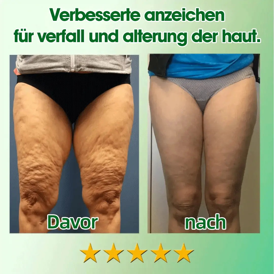 Tnnedey® 30 Kräuterstraffende Schlankheits- & Detox-Fußbadkugeln 🌿✨ - Effektive Behandlung für hohen Blutzucker 💉 und Arthritis 🦶💪