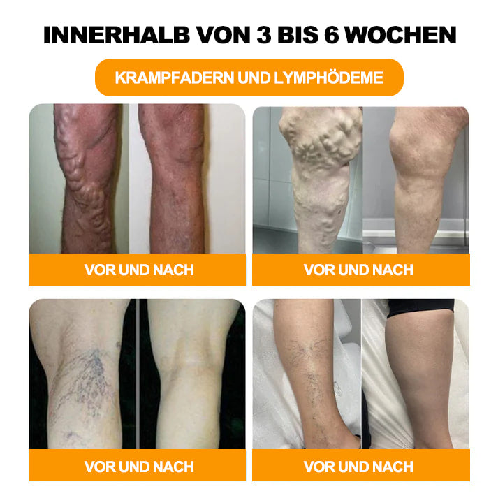 Letzter Tag, um 70 % RABATT zu erhalten: Tnnedey® Bienengift- & 30-Kräuter-Detox-Fußbad-Perlen zur Körperformung – Empfohlen von der Deutschen Lymphatischen Akademie (DLA) 🧀