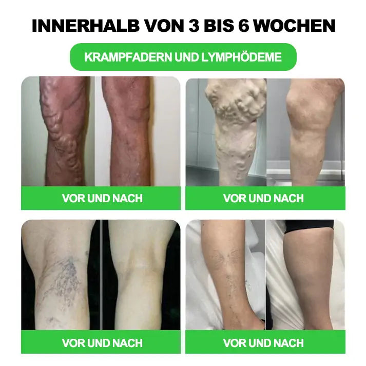 Tnnedey® 30 Kräuterstraffende Schlankheits- & Detox-Fußbadkugeln 🌿✨ - Effektive Behandlung für hohen Blutzucker 💉 und Arthritis 🦶💪