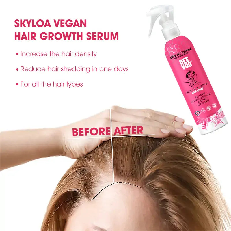 DeeVoo™   Luxe Bee venom Scalp Treatment HairGrᴏᴡth Hair Spray(Hurry, 80% OFF - Only 30 minutes left 🫧)